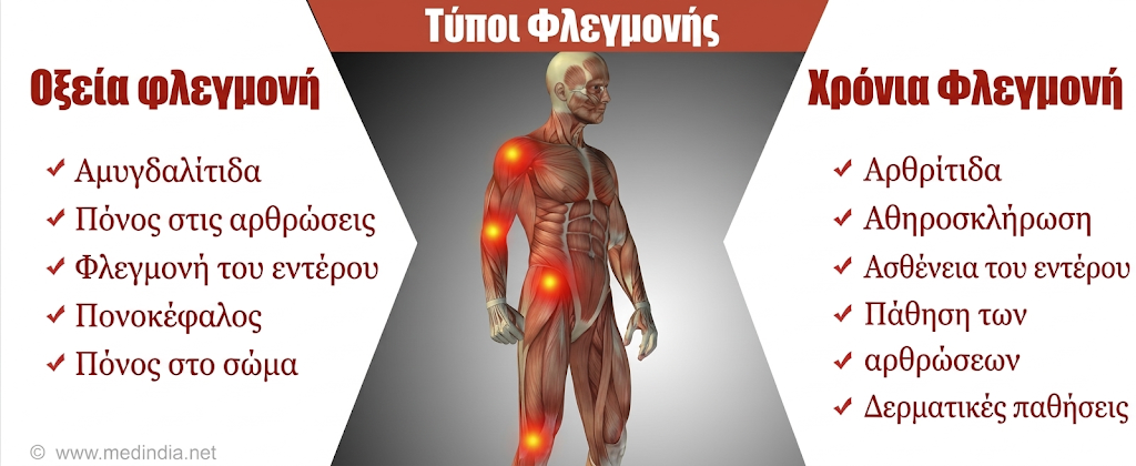 Αντιφλεγμονώδη και παυσίπονα σε τενοντίτιδες και θλάσεις: βοηθούν ή καθυστερούν την αποθεραπεία;